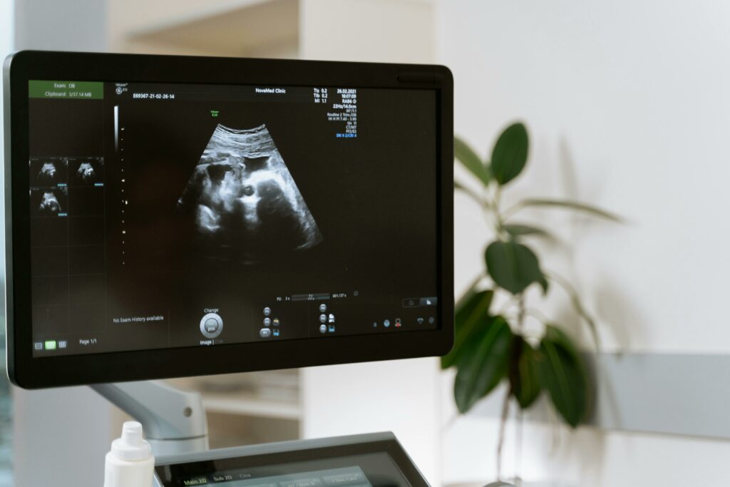 diagnostique anténatal gynécologue bretéché